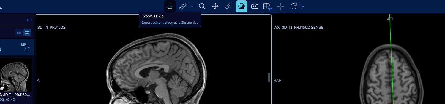 OHIF Viewer Zip Export Extension screenshot